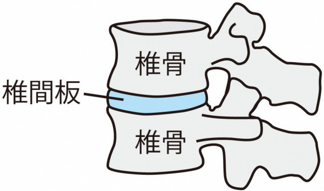 椎間板とは