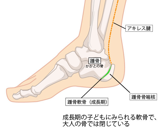 踵骨のイラスト